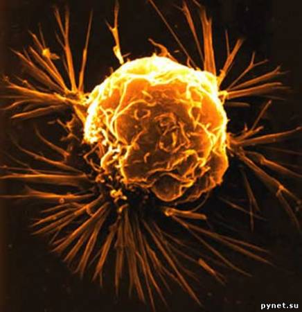 Ученые сделают раковые клетки уязвимыми. Изображение 1